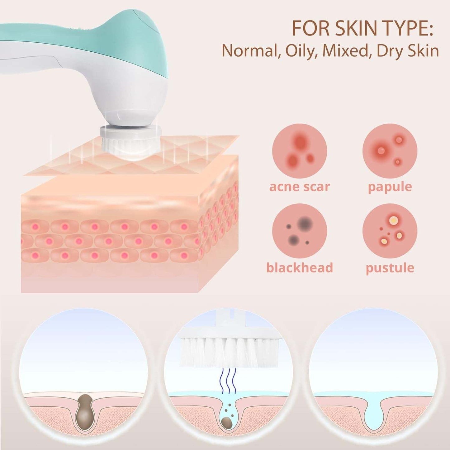 Facial cleansing and exfoliating brush removing blackheads, acne scars, papules, and pustules for all skin types including normal, oily, mixed, and dry skin.