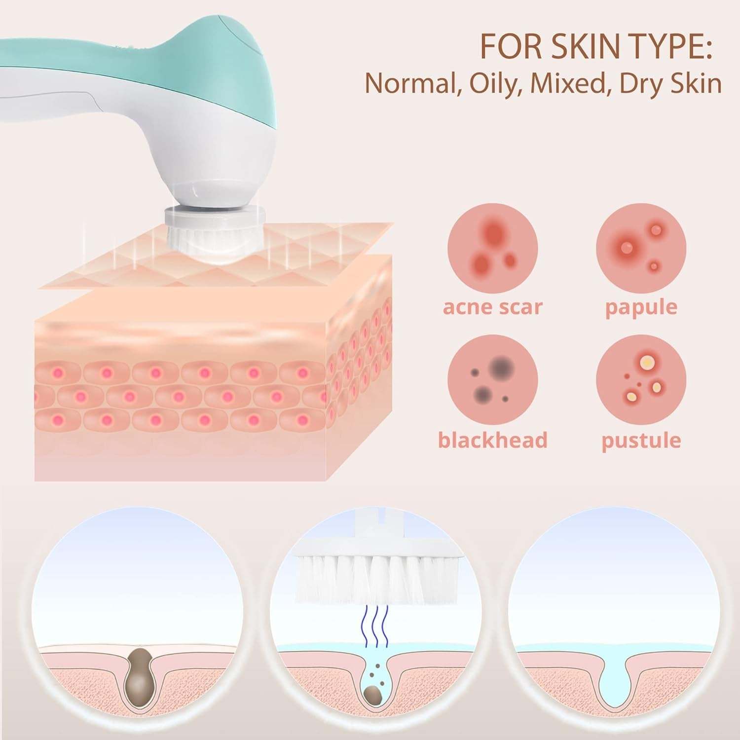 Facial cleansing and exfoliating brush removing blackheads, acne scars, papules, and pustules for all skin types including normal, oily, mixed, and dry skin.